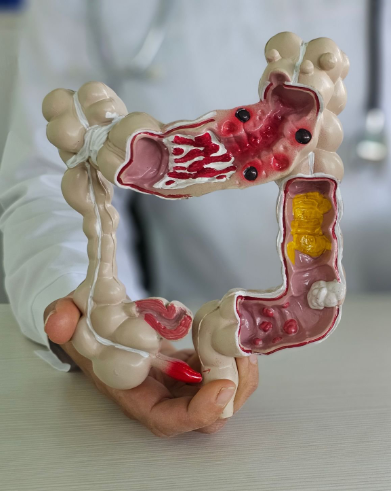 Resep Herbal HNI HPAI Apa itu Colon Cleansing?